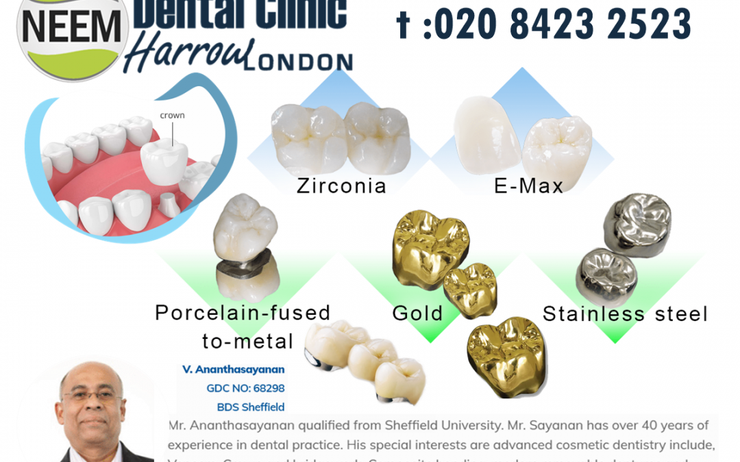 Here is Why You May Need Dental Crowns Instead of a Filling