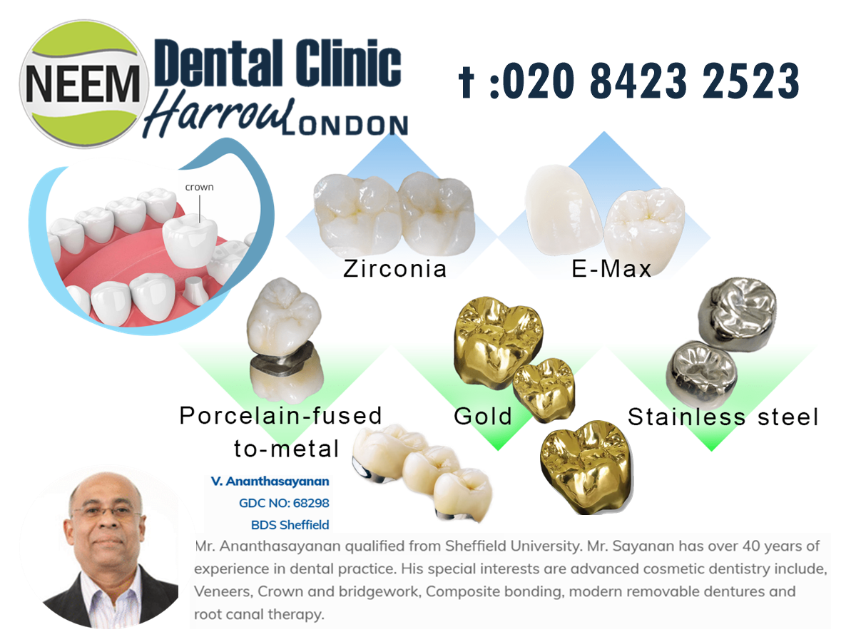 Here is Why You May Need Dental Crowns Instead of a Filling