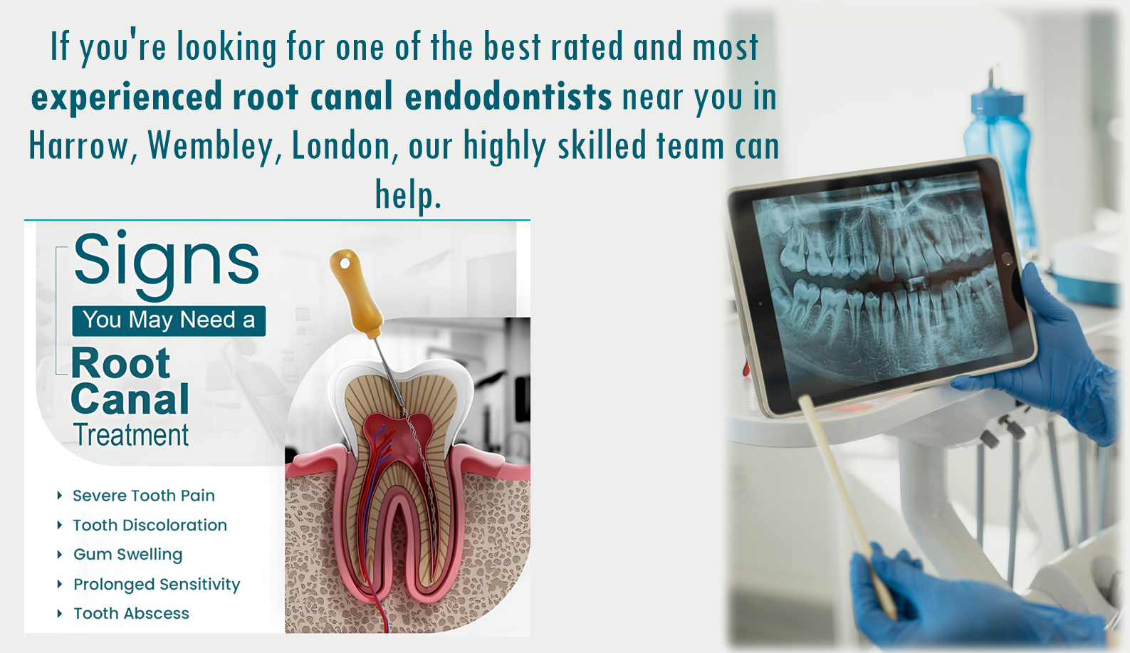 Endodontist Near Me Wembley