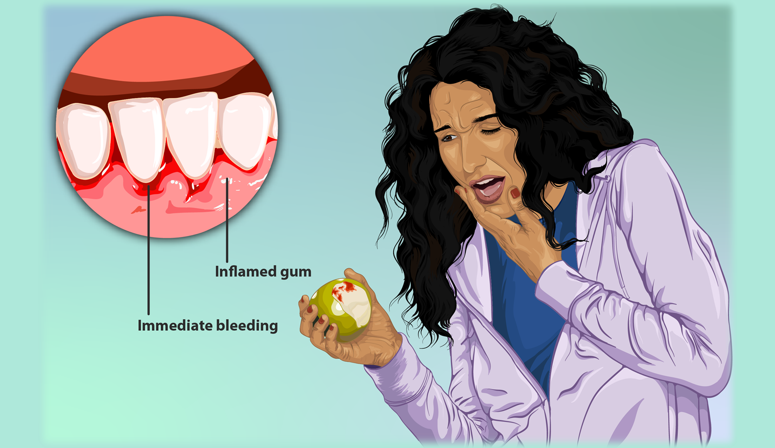Gum Disease - Scaling and Root Planning