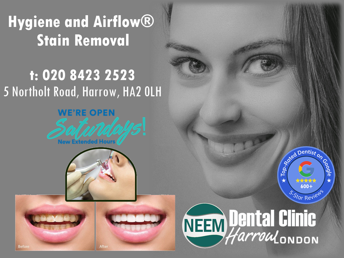 Direct Access Dental Hygienist Wembley London